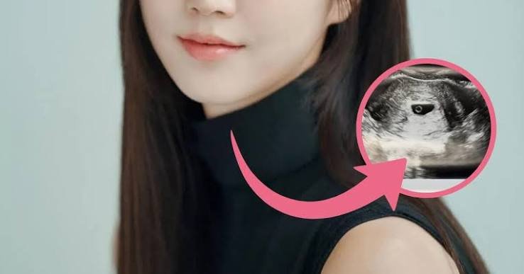 Hong Yookyung, former K-pop idol, baby bump, Hong Yookyung pregnancy, Apink Hong Yookyung, maternity shoot, K-pop idol pregnant, Dangdang, Apink members 2026, K-pop baby news, former idol mother, Korean celebrity pregnancy, K-pop maternity photos